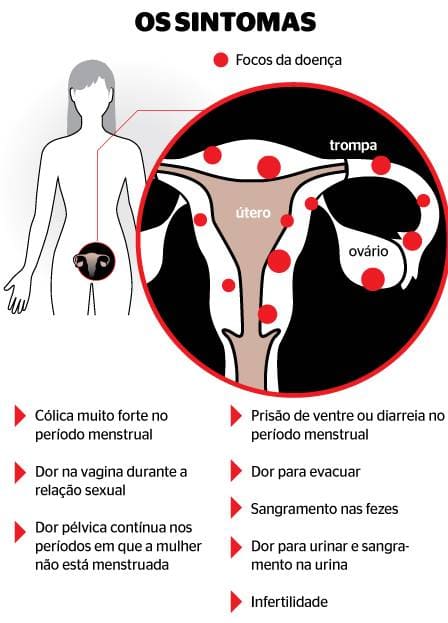 Menstruação com coágulos, o que é? Principais causas e tratamentos